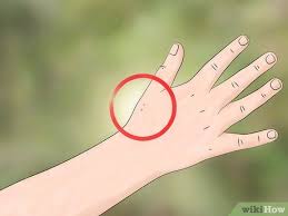 False black widow spiders have a similar shape to widow spiders. How To Identify And Treat Black Widow Spider Bites 10 Steps