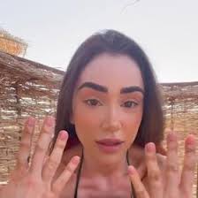 Veronica Biasiol šla s kůží na trh: V emotivním videu přiznala, že má  vitiligo