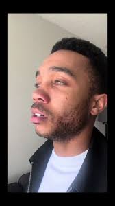 Lamentando la Pérdida del Cabello: Un Poema