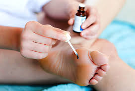 Plantar warts can be painful, annoying and embarrassing, so knowing how to treat warts on your feet can alleviate pain, discomfort and the social stigma that come along with the condition. Warts Pictures Causes Types Removal And Treatment