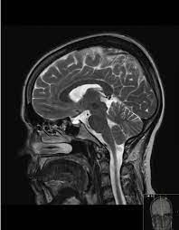 It may not display this or other websites correctly. Mrt Slk Kliniken