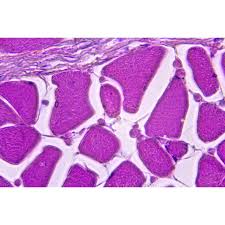 Image result for tonsilla palatina