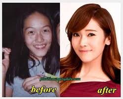 Top 5 Surprising Korean Plastic Surgery Korean Plastic Surgery Plastic Surgery Extreme Makeover