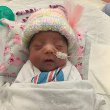 Our Sophia Ruth was born at 24 weeks and weighed 1lb 9oz. My water broke  and had a breech delivery 48 hours later. The first two weeks were touch  and go. My