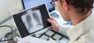 Lung cancer is the most common cause of cancer death worldwide, and there is accumulating higher level evidence that a mortality benefit exists with. Oncimmune Holdings Plc S Early Stage Lung Cancer Test Gets Nice Backing