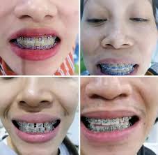 Any affordable and recommended dental services in area. TIA