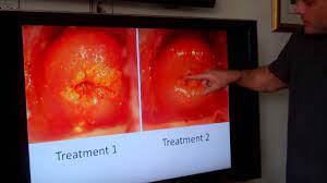 Home Test Dr Nick Leroy