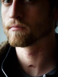 In Spencer, suicide attempt raises questions about faith-based treatment