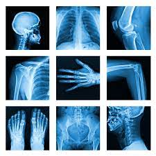 Cabinet de radiologie clinique saint vincent. Imagerie Medicale Radiographie Scanner Mammographie Echographie Panoramique Dentaire Dentascan Et Osteodensitometrie Ch Cm