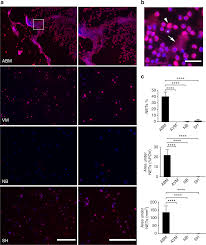 Less common causes are e. Neutrophil Extracellular Traps In The Central Nervous System Hinder Bacterial Clearance During Pneumococcal Meningitis Nature Communications
