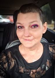 Throwback Thursday! First picture, I was 9 months sober suffering terribly  from end stage liver disease. Ascites made me LOOK 9 months pregnant. Even  when being treated at the hospital I would