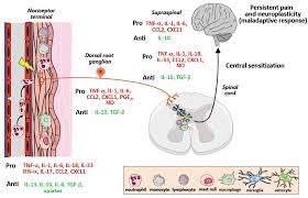 Image result for Cancer Pain