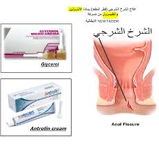 بعيدا عن العمليات الجراحية علاج الشرخ الشرجي فطر المقعد Photos Facebook
