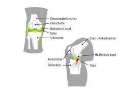 Knieschmerz innen und keine diagnose?! Knieschmerzen Ursachen Diagnose Hilfe Joggen Online