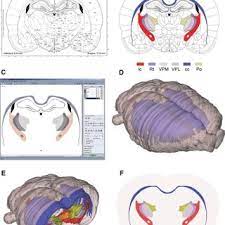 An rna seq atlas of gene expression. Pdf Three Dimensional Atlas System For Mouse And Rat Brain Imaging Data