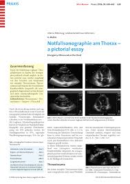 Broadening of the pleural line to a. Pdf Notfallsonographie Am Thorax A Pictorial Essay