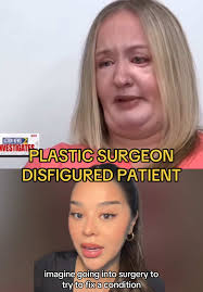 Karla from Botched