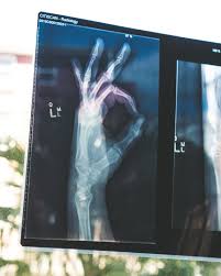 Neuraltherapie Bei Arthrose Information Behandlung