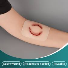 Image result for Human Bite