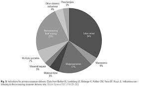 Priorities For Reduction Of Low Risk Cesarean Section Rates Survey Cesarean Delivery Cesarean Cesarean Section