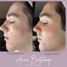 Glow Skincare & Wax (@glowskincareandwax) • Instagram photos and videos