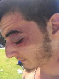 Eğlenmek için gittiği festivalde darp edildi!