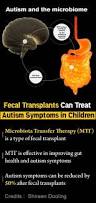 Image result for Fecal Transfer