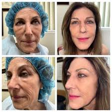 THE BEST 10 COSMETIC SURGEONS in ONTARIO, CA