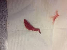 Period And Tissue What Could This Be Babycenter