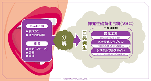 口臭について２