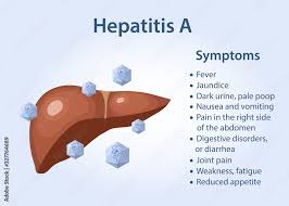 Image result for acholic stools human