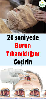 Burun Tikanikligina Cozum Natural Medicine