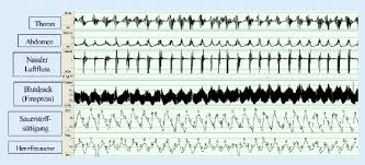 Idealerweise sollten sie ihren blutdruck zweimal täglich messen: Zirkadiane Einflusse Auf Die Kreislaufregulation Springerlink