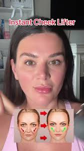 Gua Sha Verrutschtes Hyaluron