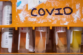 Alberta Reports 1 105 New Covid 19 Cases Thursday Ponoka News