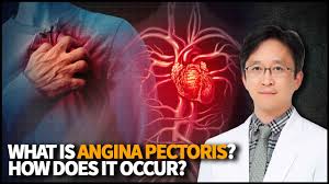 Image result for Angina Pectoris