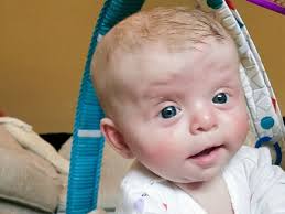 Fundraiser by Shannon Seth : Hope for Hazel