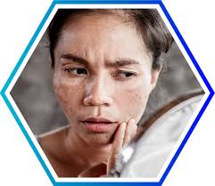 Sữa Rửa Mặt Nady White Nàng Duyên