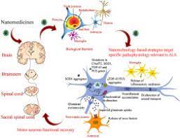 Amyotroph lateral scleros other motor neuron disord. Advances In Nanotechnology Based Strategies For The Treatments Of Amyotrophic Lateral Sclerosis Sciencedirect