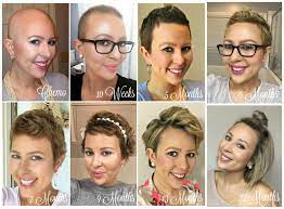 Hair Extensions 101 Growing Out Hair Hair Growth After Chemo Hair Regrowth Women