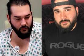 Fundraiser for Eric Rinehold by Brice Rinehold : Eric's Medical Bill