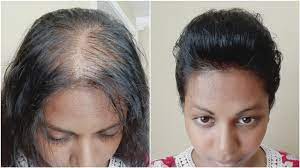 The crew cut is a hairstyle we've already written about in our article regarding army haircuts. Style My Thin Hair With Me Big Front Puff Youtube