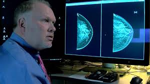 3-D mammography brings clarity to fight against breast cancer