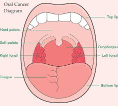Life expectancy in dogs with mouth cancer is better when the growth is discovered early, when it's still what do these cancers generally look like? Oral Wound And Mouth Cancer Treatment Dr Turkey