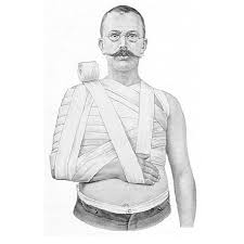 Desault S Bandage Is Shown Reprinted From Hoffa A Grashey R Download Scientific Diagram