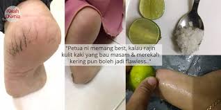 Tumit adalah bagian kaki yang mudah kering dan membutuhkan perawatan khusus. Malu Tumit Kaki Merekah Pecah Tak Sangka Guna 5 Bahan Dapur Je Boleh Mujarab Kisah Dunia