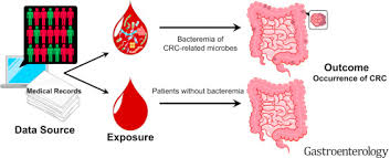 How does colorectal cancer spread? Association Between Bacteremia From Specific Microbes And Subsequent Diagnosis Of Colorectal Cancer Gastroenterology