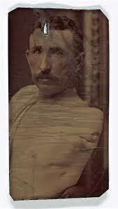 BENEATH HIS SHIRT SLEEVES: Evidence of Injury