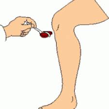 Image result for Reflex Exam