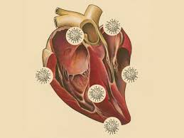 После look нужно использовать прилагательное. What Covid 19 Does To The Heart The Atlantic